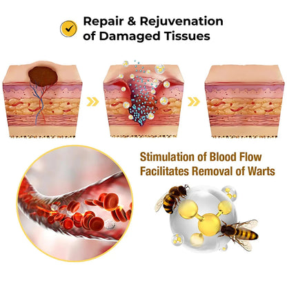 Derma Smooth Painless Skin Tag Removal Patch