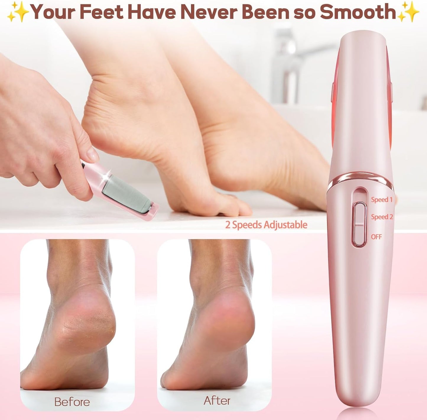 Electric Callus Remover