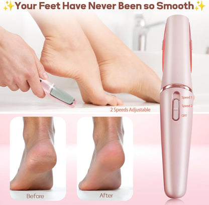 Electric Callus Remover