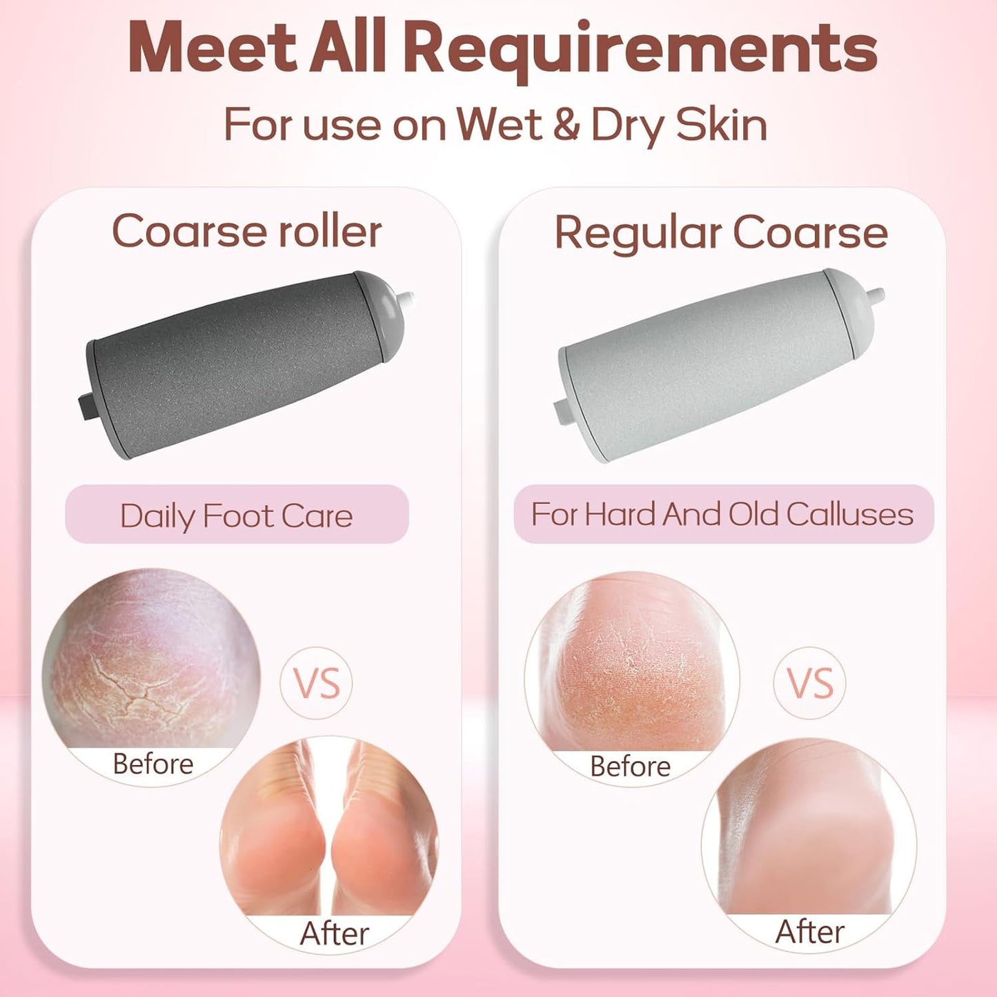 Electric Callus Remover