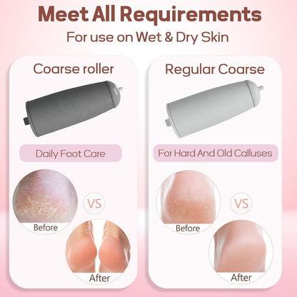 Electric Callus Remover